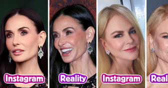 10+ Celebrities Who Remind Us Not to Trust Every Perfect Photo