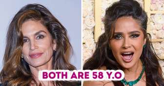 Side-by-Side Photos of Same-Age Stars with Cosmetic Procedures and Without