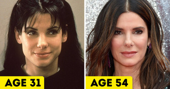 20 Celebrities Who Said “No” to Comestic Surgery and “Yes” to Aging Naturally