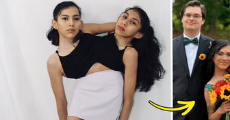 One Conjoined Twin Got Married — And Everyone’s Asking the Same Question