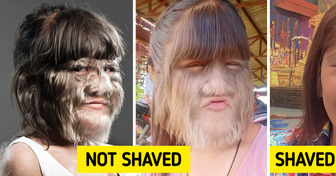 The World’s Hairiest Girl Grew Up and Decided To Astonish Everyone With Her New Look
