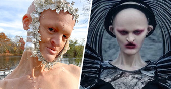 Meet the Model With a Rare Genetic Disorder Who Proves Beauty Has No Rules