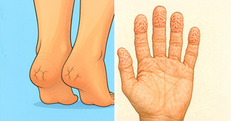 8 Imperceptible Changes in Your Body that Could Be Warning of Health Problems