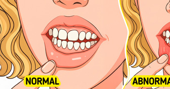 6 Quiet Warnings of a Stomach Ulcer You Could Easily Mistake for Routine