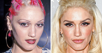 15 Celebrities Who Changed Their Eyebrows and Achieved a Totally Different Look