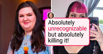 14 People Who Chose Plastic Surgery — and Were Absolutely Stunned by the Results