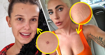 Unfiltered and Unapologetic: 15+ Stars Who Show Their True Selves