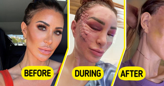 This Woman’s Unique Facelift Leaves Everyone Speechless