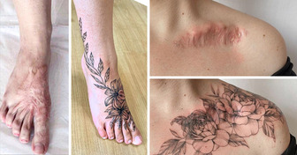 15 Scars That Were Turned Into Works of Art and Are Worthy of Being Shown Off