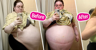 I Was Shamed by Doctors for Years — Until a Shocking Truth Was Finally Revealed