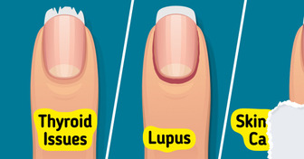 10+ Ways Your Body Could Alert You to Hidden Health Issues