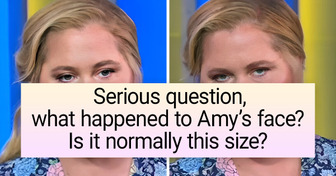 Amy Schumer Looks Unrecognizable and People Have Started To Worry About Her Health