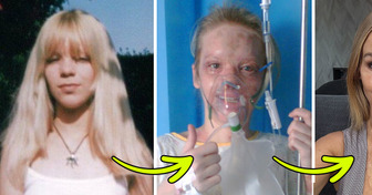 16 Years After the ACID ATTACK: Katie Piper’s Remarkable Update on Her Journey