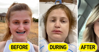 Her Double Jaw Surgery Left Everyone Speechless