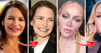 10 Celebrities Who Removed Fillers and Left Everyone Speechless