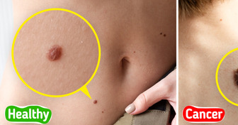 8 Sneaky Signs Your Skin May Be Revealing Serious Health Problems