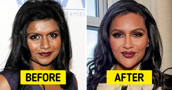 10+ Times Celebrities Left Us Speechless with Their Drastic Transformations