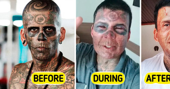 95% Tattooed Man REMOVES His Ink — The Transformation Is Unreal