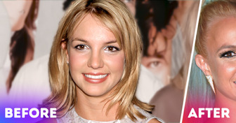 Why Britney Spears’ Facial Transformation Stirs Such a Heated Controversy