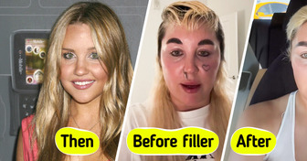 Amanda Bynes, 39, Revealed Her Dramatic New Look, Leaving People in Awe