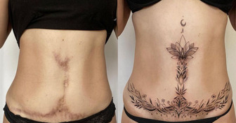 15 People Who Had Their Scars Turned Into Admirable Artwork
