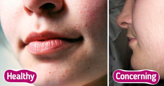 7 Alarming Signs Your Body Might Be Craving Vitamin D