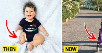 Doctors Were Speechless, but This Mom Saw Only Love — A Baby Born With Limb Differences