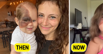 Mom Turns Daughter’s Rare Birthmark Into a Beautiful Superpower