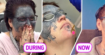 Woman’s Face Was Marked with Tattoos She Never Wanted — Now She’s Finally Erasing Them