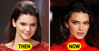 Kendall Jenner, 30, Finally Speaks Out About Plastic Surgery Speculation