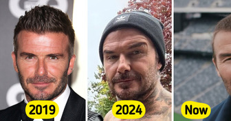 “Those Cheek Fillers Are Wild,” David Beckham’s New Face Sparks Heated Controversy