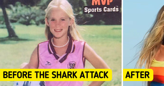 Bethany Hamilton Survived a Shark Attack and Became a Mom of 4