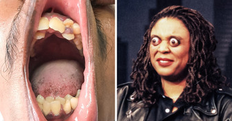 10+ People With Extraordinary Physical Features That Will Leave You Baffled