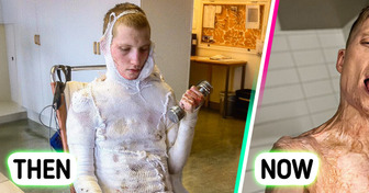 A Singer Who Survived a Horrific Electric Shock Celebrates Remarkable Recovery and New Appearance