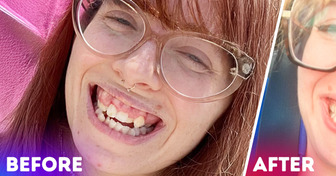 17 People Who Got a New Smile and Now Look Completely Unrecognizable