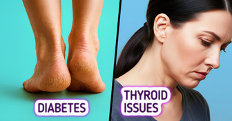 10+ Crucial Body Clues That Could Be Whispering Something About Your Health