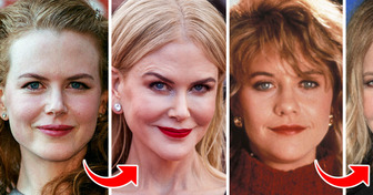 10+ Famous People Whose Appearances Changed Beyond Recognition