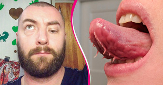 18 People Gifted with Fascinating Body Features