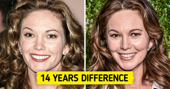 15 Celebrities Who Must Have Found the Secret to Eternal Youth