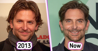 Bradley Cooper, 51, Finally Speaks Out About Ongoing Plastic Surgery Rumors