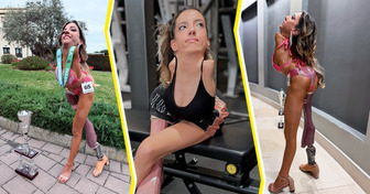 She Was Born Without Arms and a Leg — Now She’s Inspiring Millions