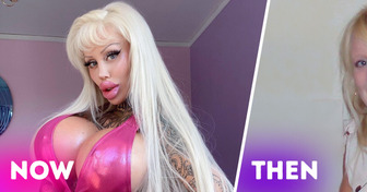 “I Want to Look as Plastic as Possible,” Woman Spends a Fortune to Transform into a Living Barbie Doll