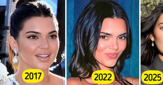 “She Doesn’t Even Look Like The Same Person,” Kendall Jenner Addresses Years Of Nose Job And Filler Rumors