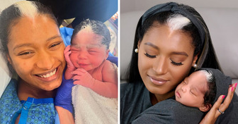 Mom with Rare Feature Gives Birth to Her Mini-Me Daughter