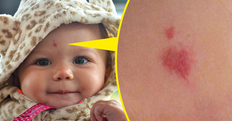 How My Niece’s Birthmark Exposed My Cheating Husband