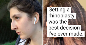 16 People Who Had No Problem Revealing How Happy They Were With Their Plastic Surgery