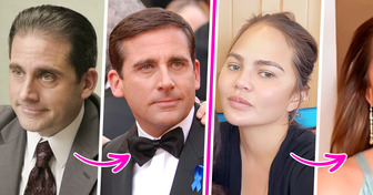 8 Celebrities Who Experienced Hair Loss — and Refused to Let It Stop Them