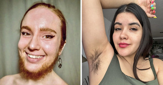 15 Women Who Ditched Their Razors and Embraced Body Hair