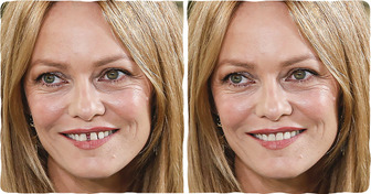 What 15 Celebrities Would Look Like Without Their Unique Imperfections