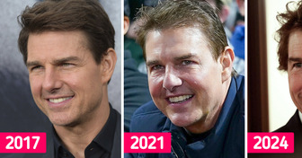 “Another Star With Far Too Many Fillers.” Tom Cruise Doesn’t Resemble Himself in the New Photos